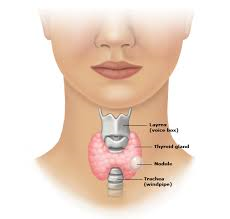 Thyroid Nodule 2015